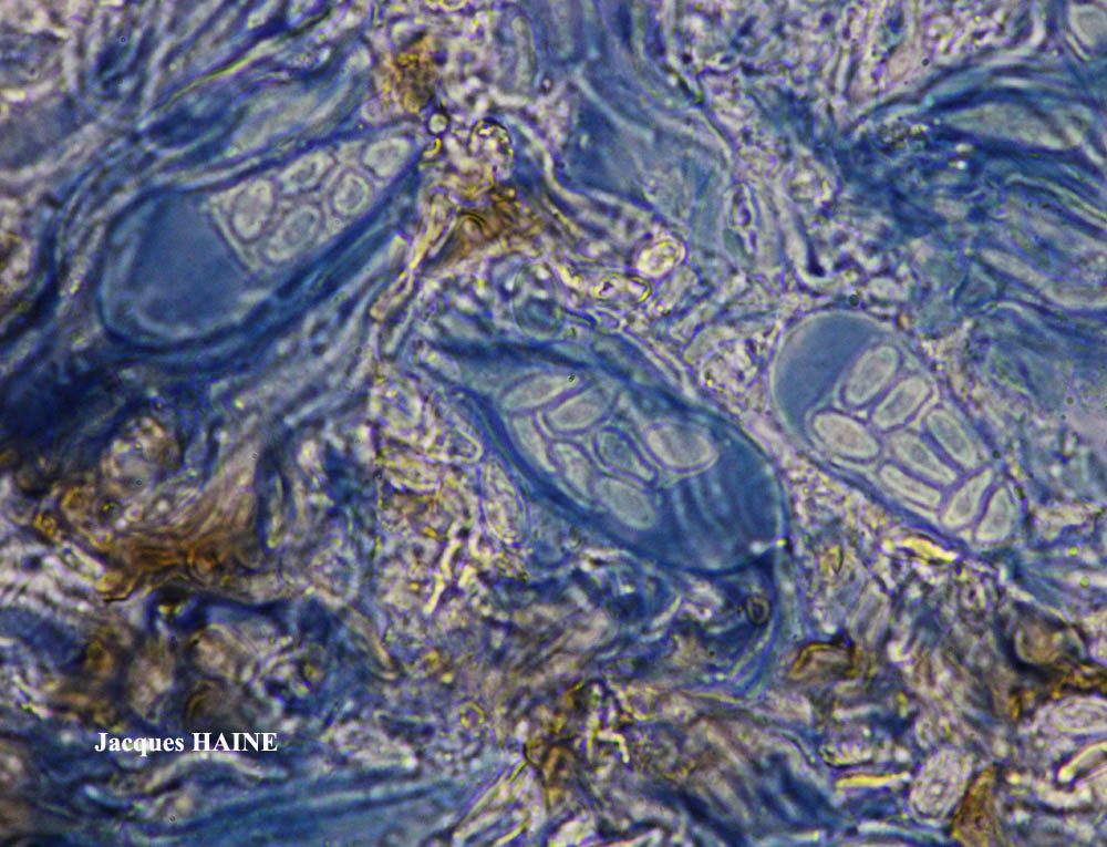 Lichens Marins Protoparmelia Atriseda Fr R Sant J V Wirth