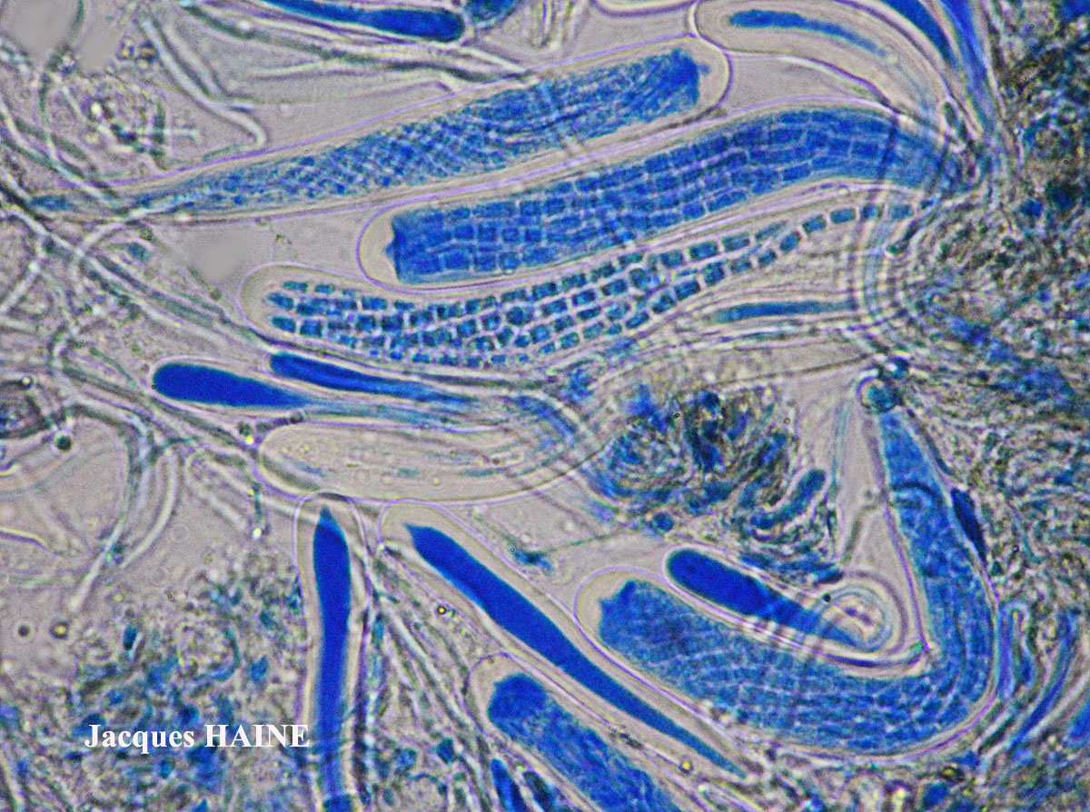 Bactrospora patellarioides (Nyl.) Almq. var. patellarioides