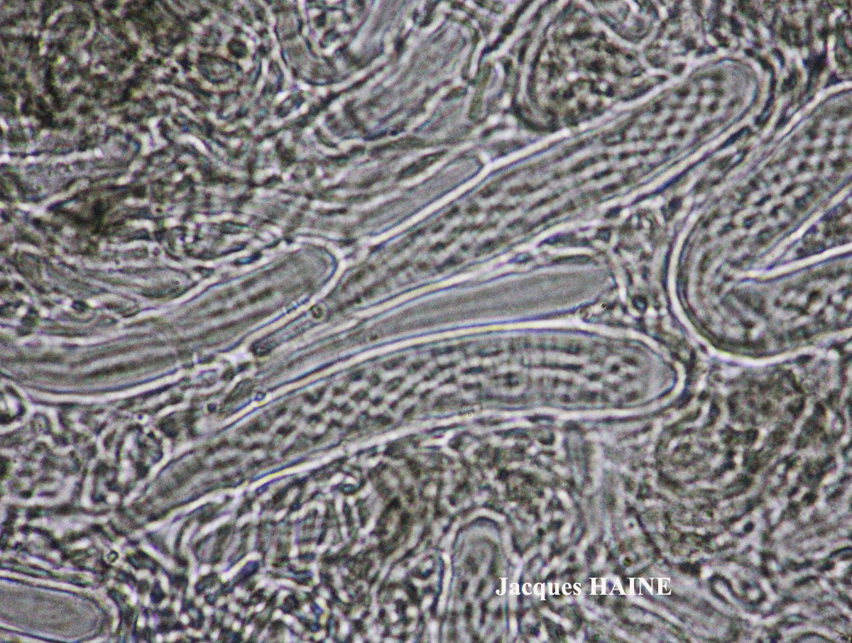 Bactrospora patellarioides (Nyl.) Almq. var. patellarioides