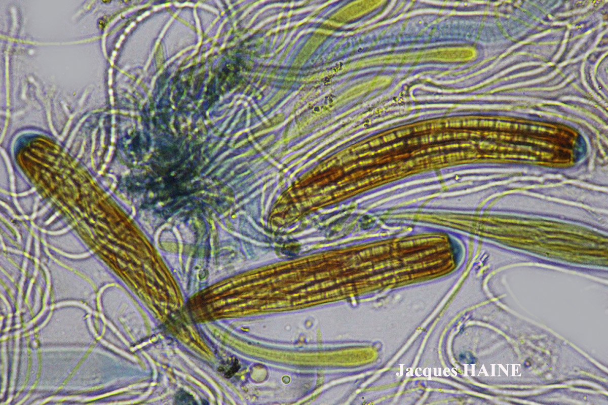 Bactrospora patellarioides (Nyl.) Almq. var. patellarioides