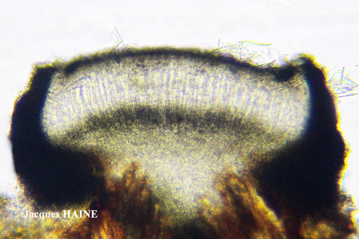 Bactrospora patellarioides (Nyl.) Almq. var. patellarioides