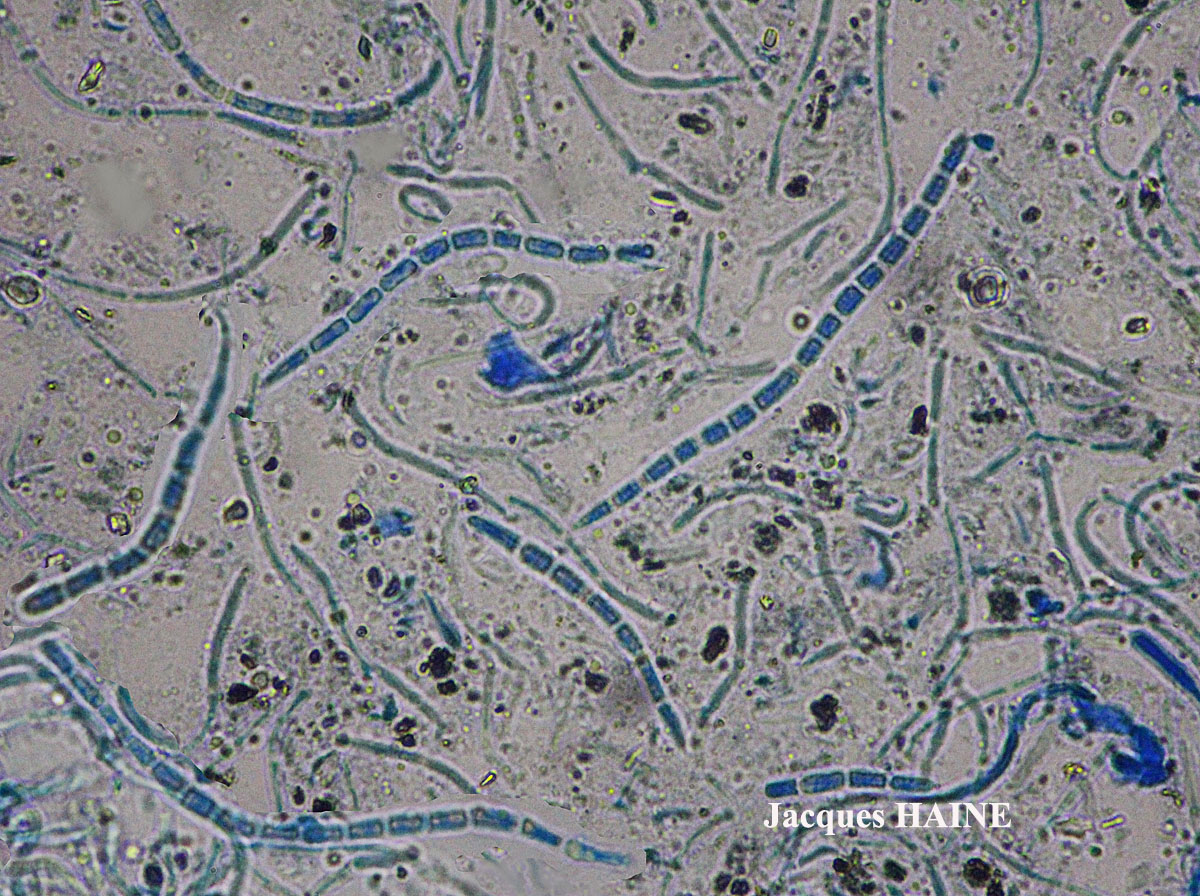 Bactrospora patellarioides (Nyl.) Almq. var. patellarioides