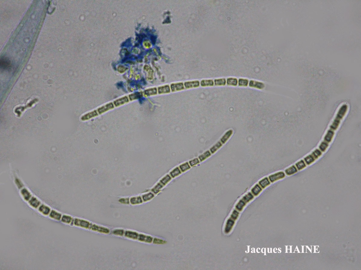Bactrospora patellarioides (Nyl.) Almq. var. patellarioides