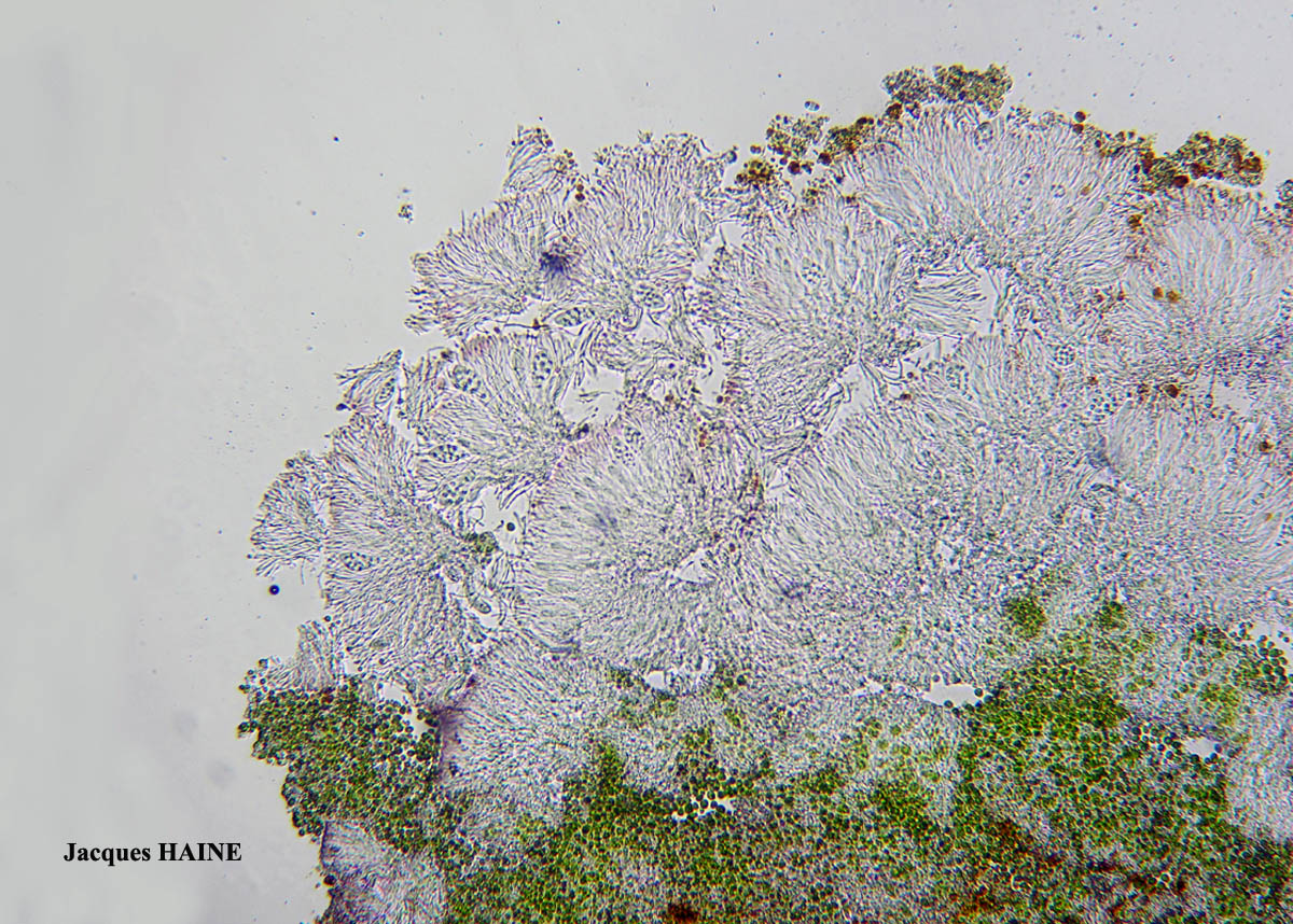 Kuettlingeria ceracea forme saxicole des murs =Caloplaca ceracea forme saxicole des murs.