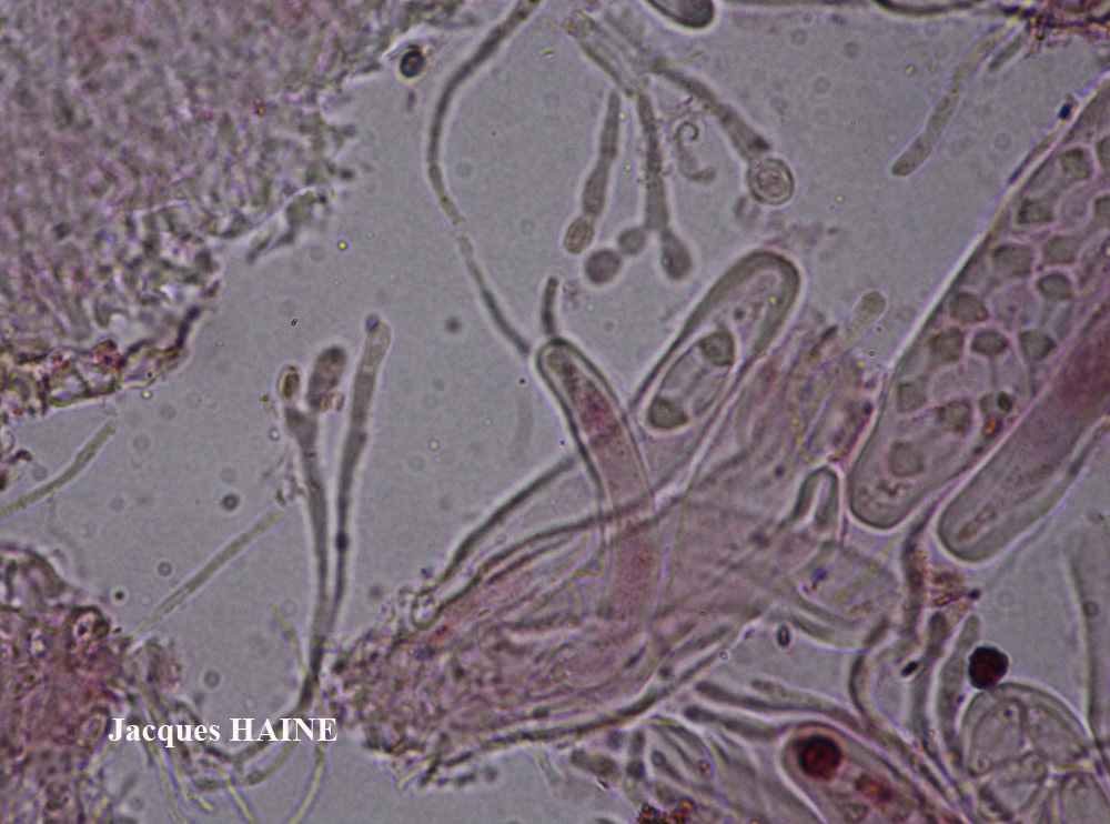 Caloplaca phlogina (Ach.) Flagey morphotype maritime.