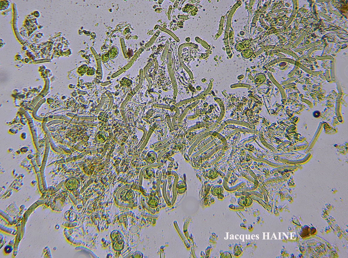Candelariella aurella Cf. forme corticole.