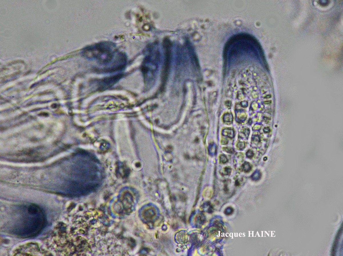 Collema ryssoleum (Tuck.) A. Schneid.
