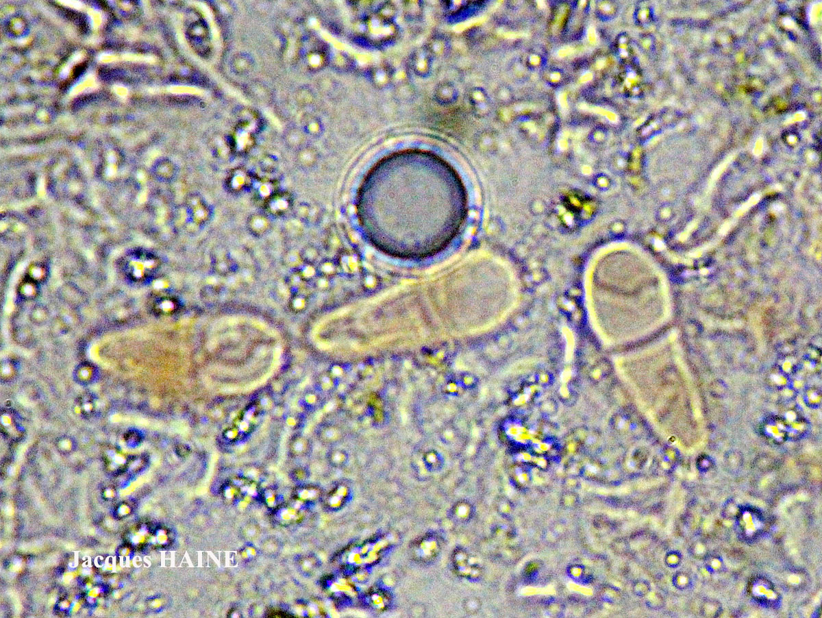 Collemopsidium ostrearum Taxon Atlantique-Manche forme saxicole.