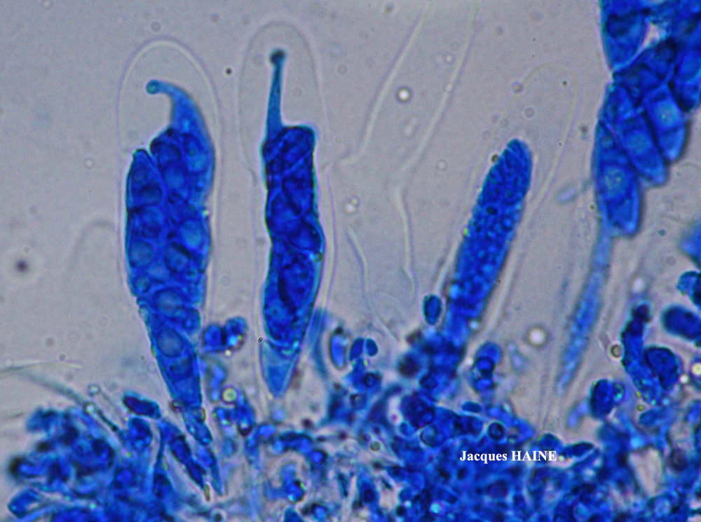 Dermatocarpon complicatum (Lightf.) W. Mann