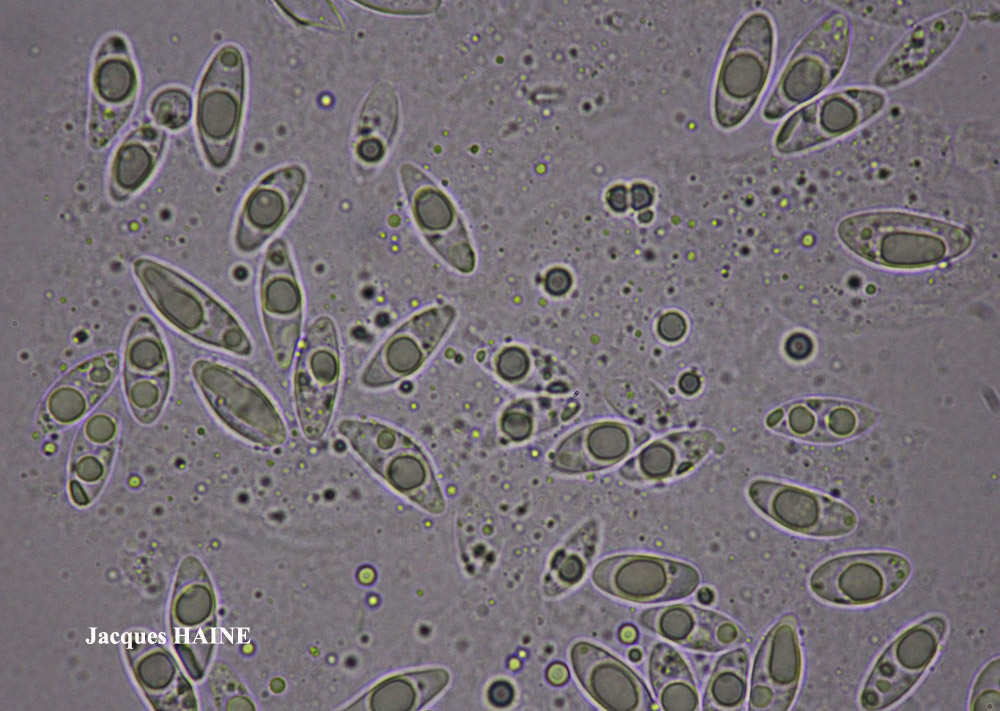 Dermatocarpon complicatum (Lightf.) W. Mann