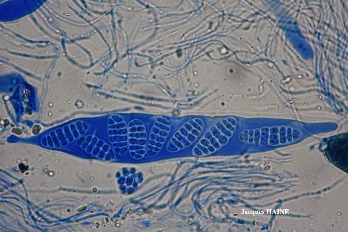 Diploschistes caesioplumbeus forme parasite de Tephromela atra ou de Lecanora gangaleoides.