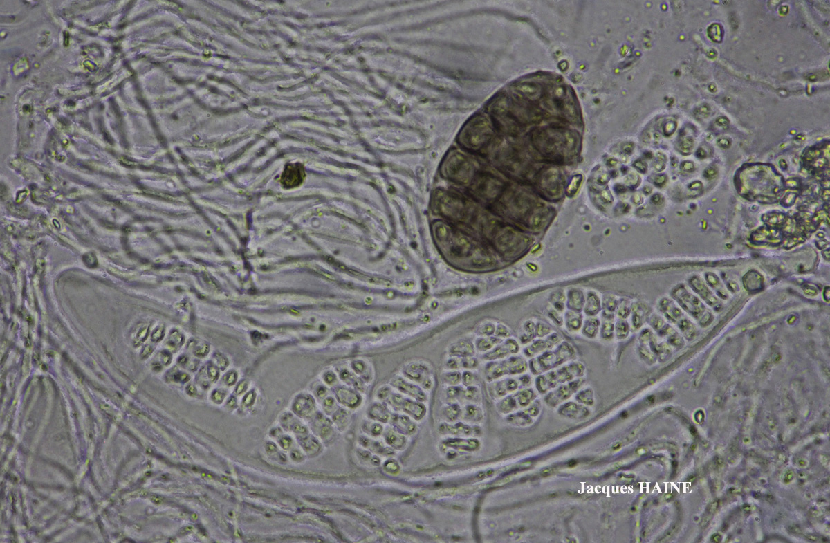 Diploschistes caesioplumbeus forme parasite de Tephromela atra ou de Lecanora gangaleoides.