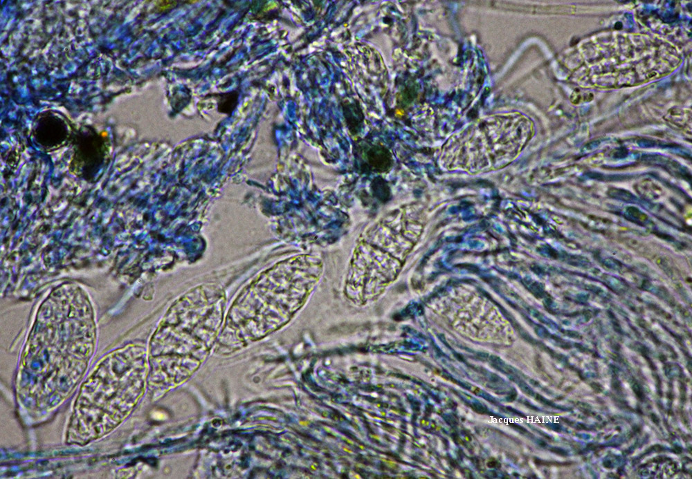Gyalecta jenensis var. macrospora forma