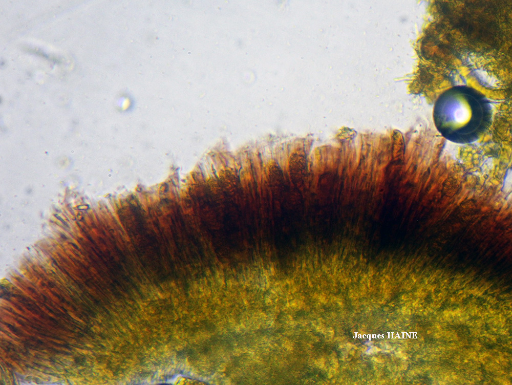 Gyalecta jenensis var. macrospora forma