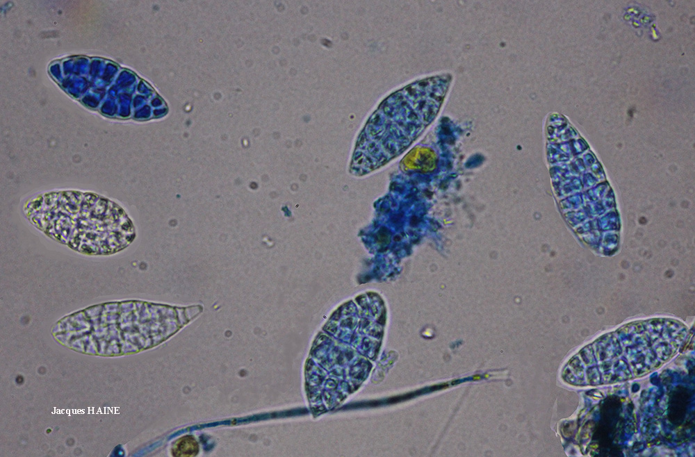 Gyalecta jenensis var. macrospora forma
