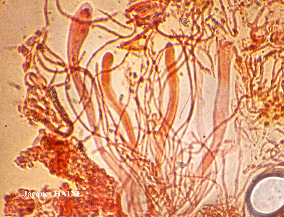 Heterodermia obscurata (Nyl.) Trevisan ss. auct. brit.