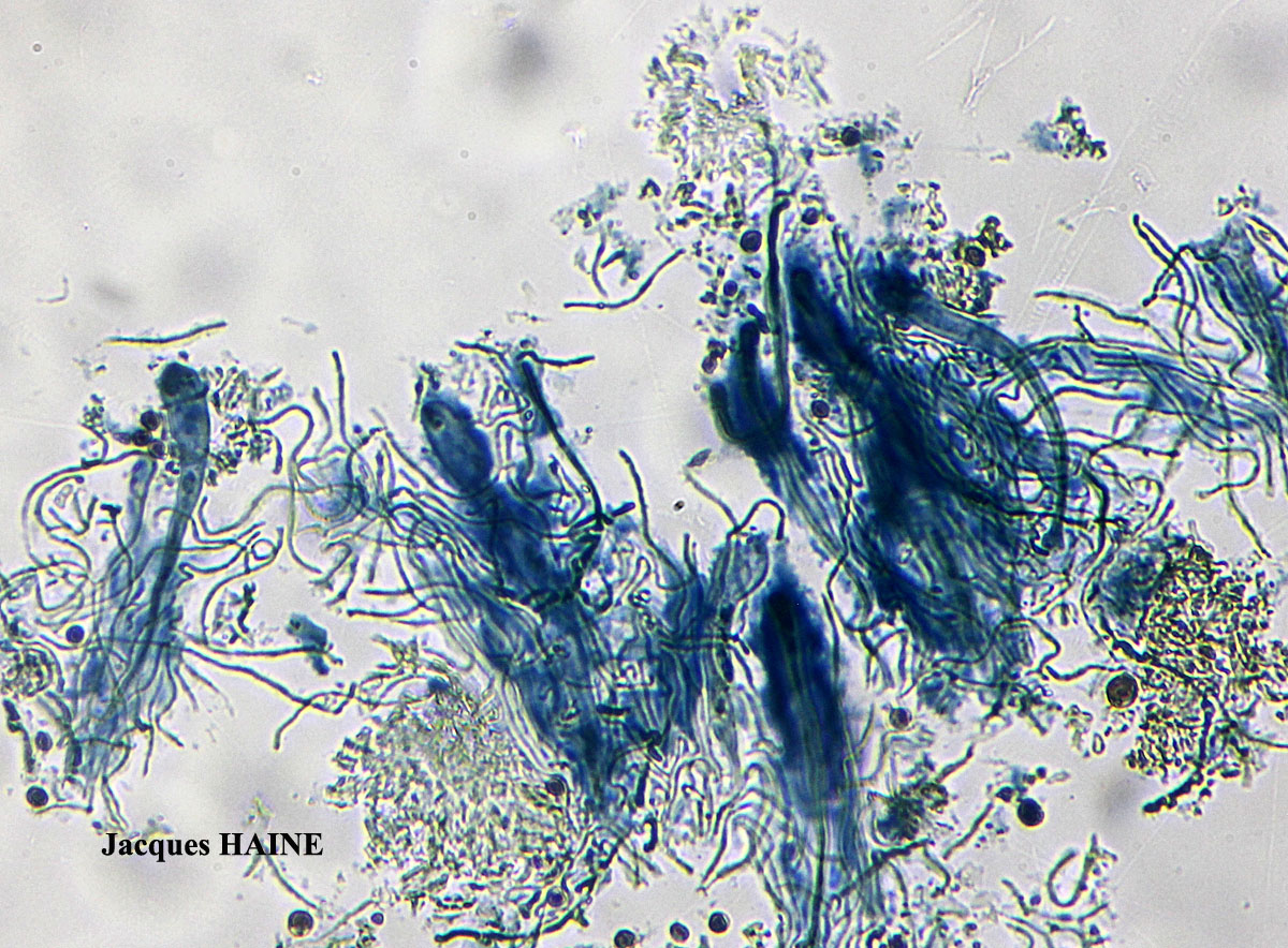 Heterodermia obscurata (Nyl.) Trevisan ss. auct. brit.