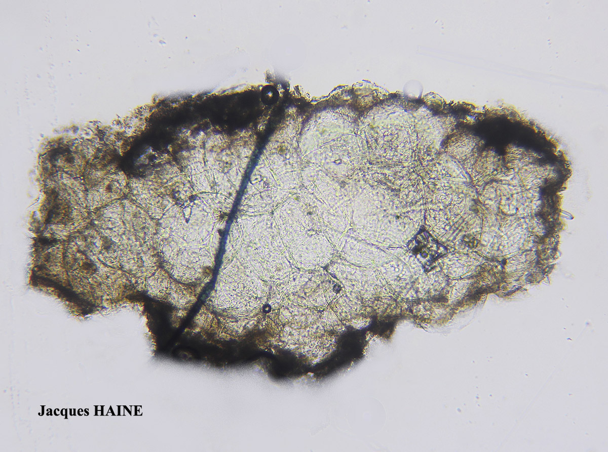 Hypogymnia physodes forme pycnidiée.
