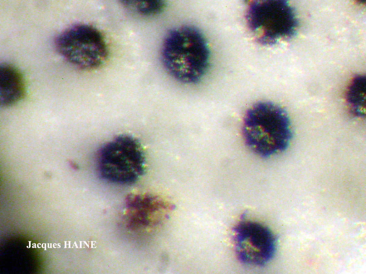 Hypogymnia physodes forme pycnidiée.