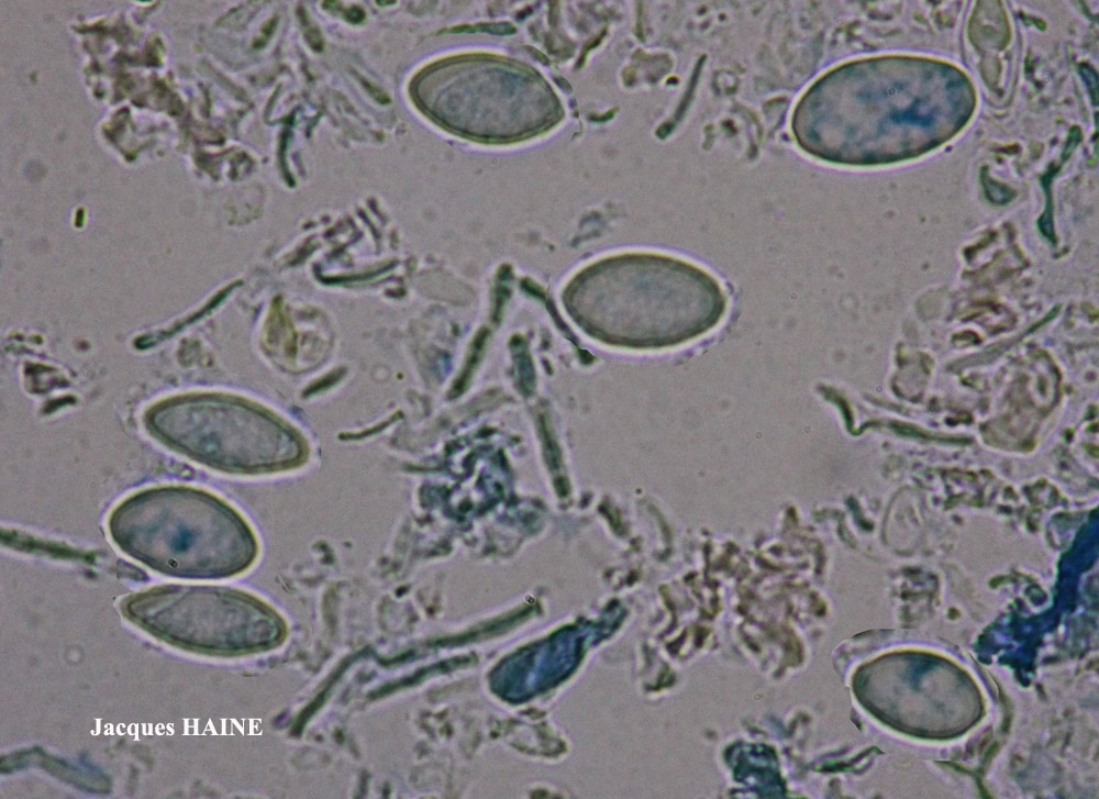 Lecanora rupicola (L.) Zahlbr. subsp. subplanata (Nyl.) Leuckert & Poelt morph. formant des mosaïques.