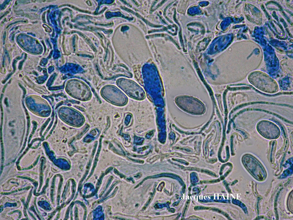 Lecanora subcarnea (Lijl.) Ach.