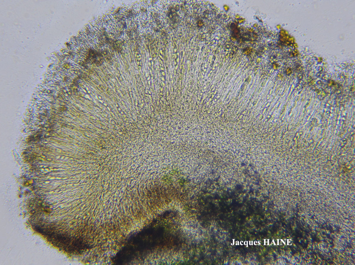 Lecidella carpathica morphotype 