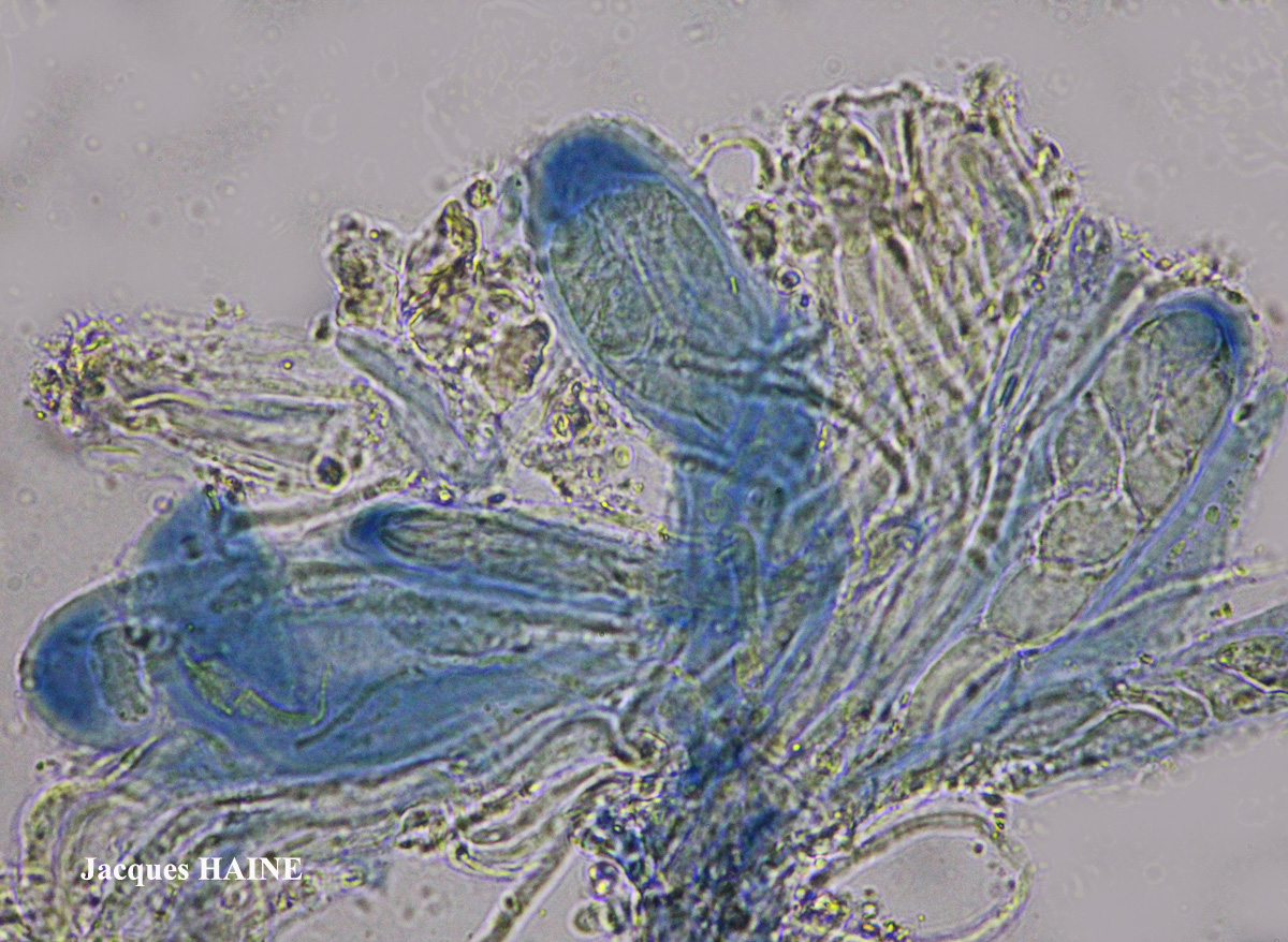 Lecidella carpathica morphotype 