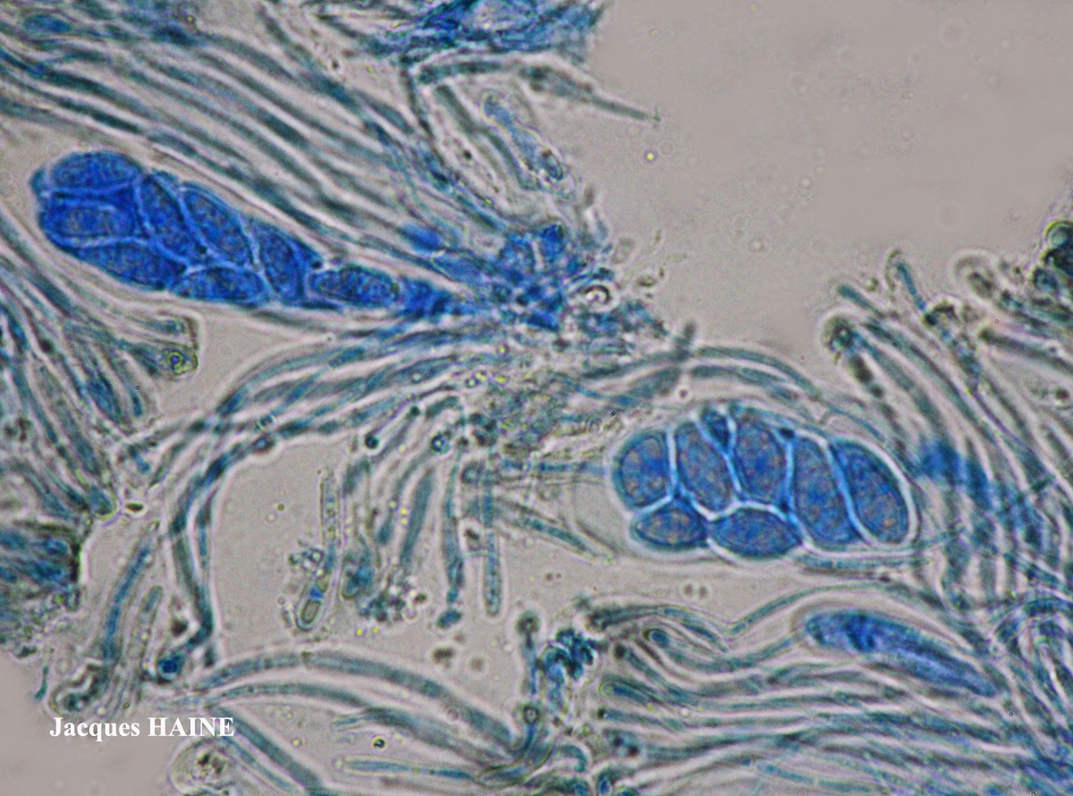 Lecidella carpathica morphotype 