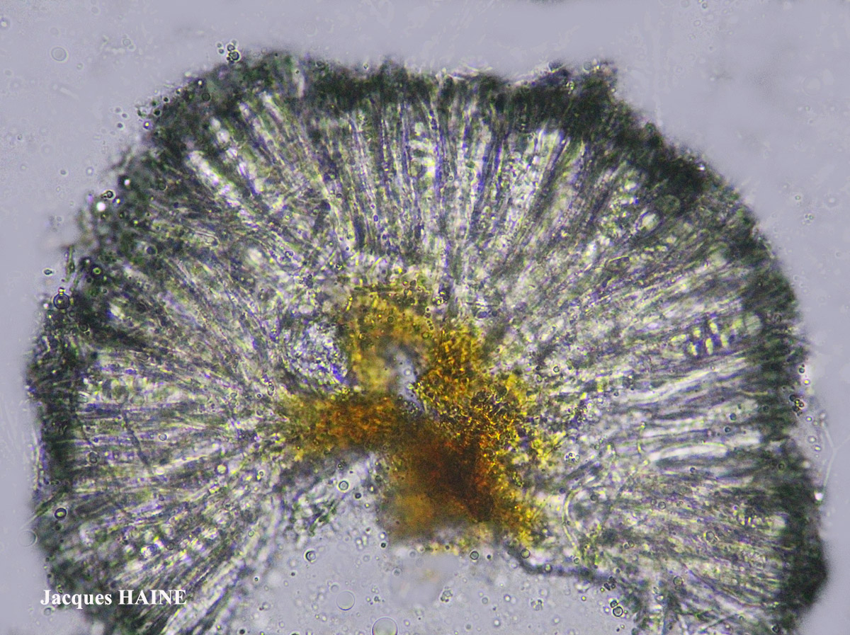 Lecidella elaeochroma chemo euphorea