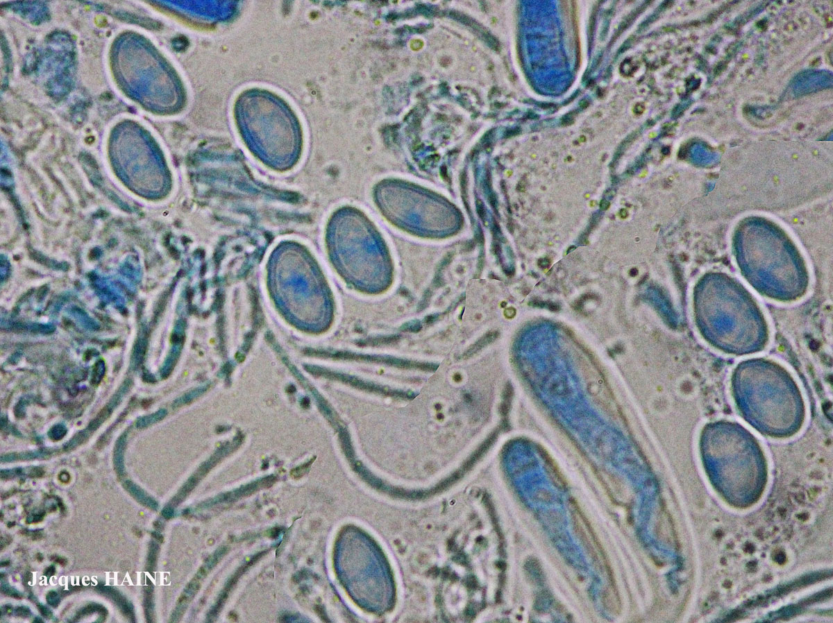 Lecidella elaeochroma chemo euphorea