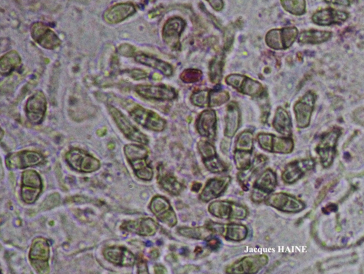 Lichenodiplis lecanorae (Vouaux) Dyko & D. Hawksw.