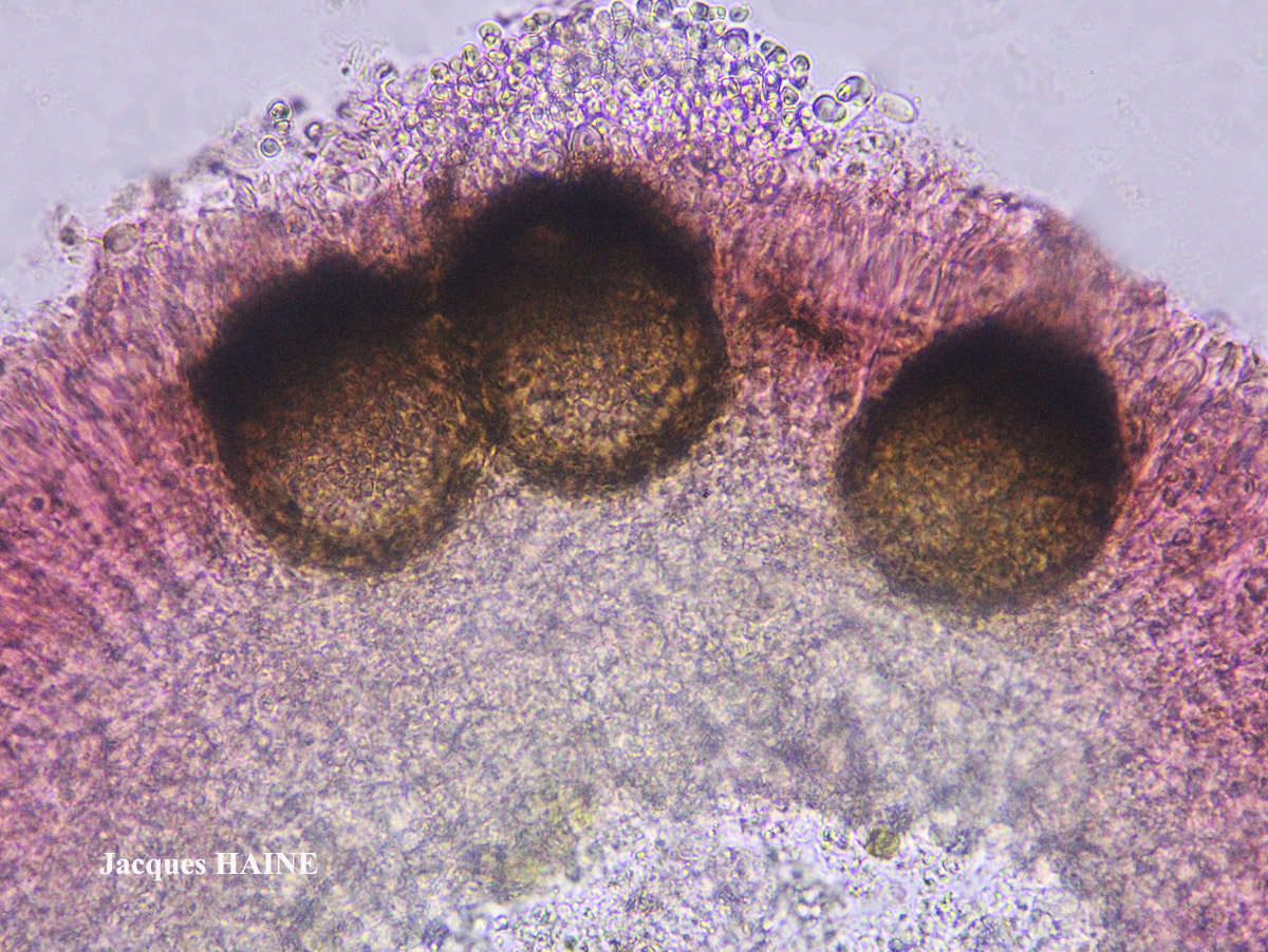 Lichenodiplis lecanorae (Vouaux) Dyko & D. Hawksw.