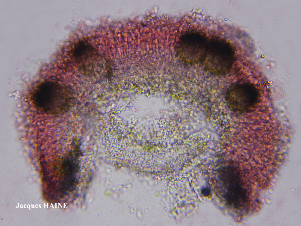 Lichenodiplis lecanorae (Vouaux) Dyko & D. Hawksw.