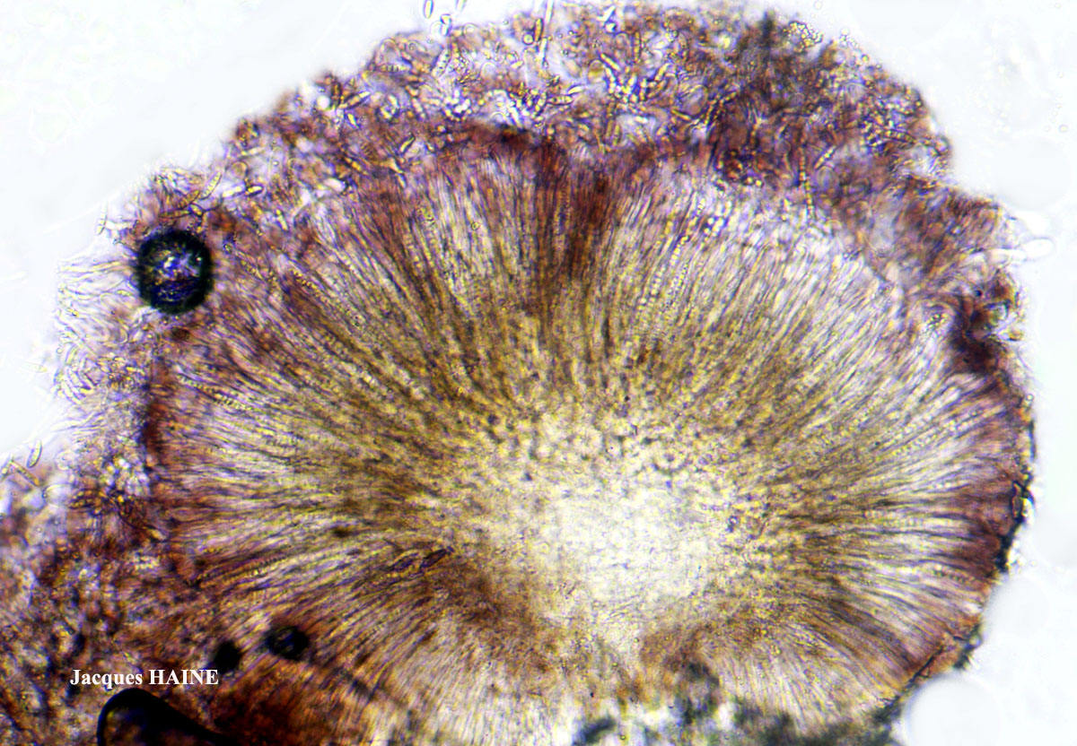 Micarea lignaria var. endoleuca (Leight.) Coppins