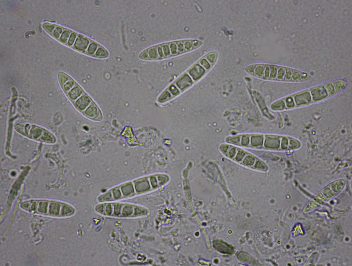 Micarea lignaria var. endoleuca (Leight.) Coppins