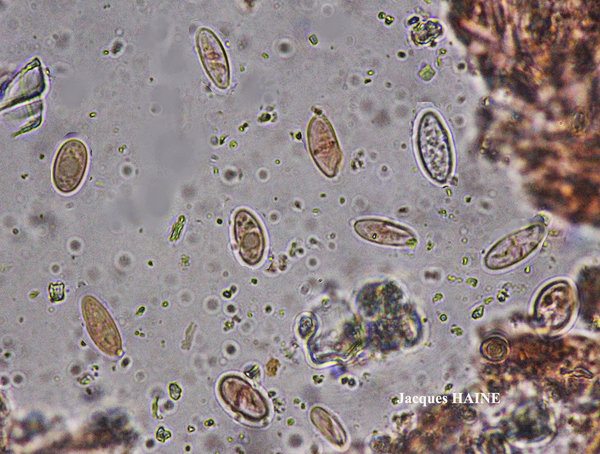 Polyozosia semipallida (H. Magn.) S.Y. Kondr., Lökös & Farkas forme nitrophile sur ciment.
= Myriolecis semipallida forme nitrophile sur ciment.