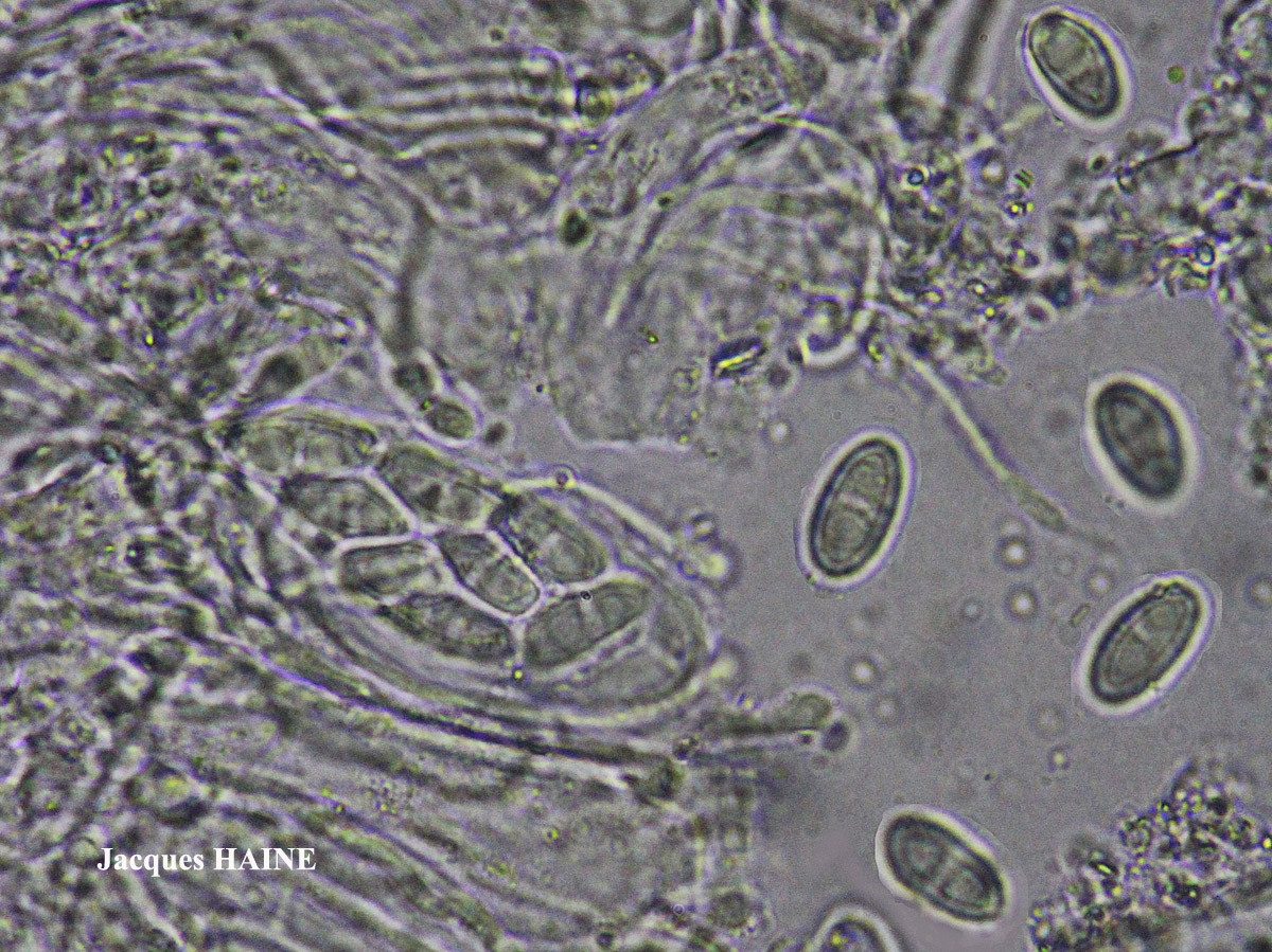 Polyozosia semipallida (H. Magn.) S.Y. Kondr., Lökös & Farkas forme sur béton.
= Myriolecis semipallida forme sur béton.