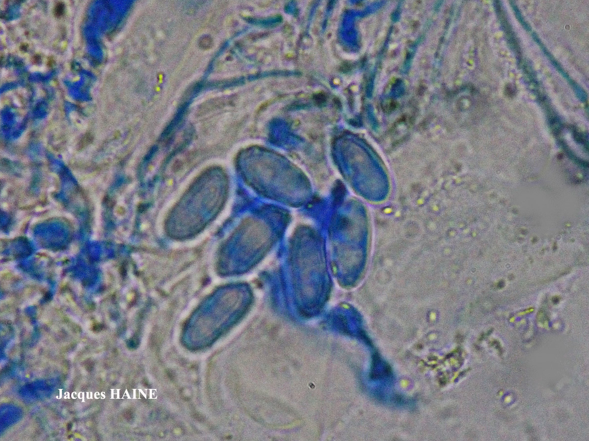 Polyozosia semipallida (H. Magn.) S.Y. Kondr., Lökös & Farkas forme sur béton.
= Myriolecis semipallida forme sur béton.