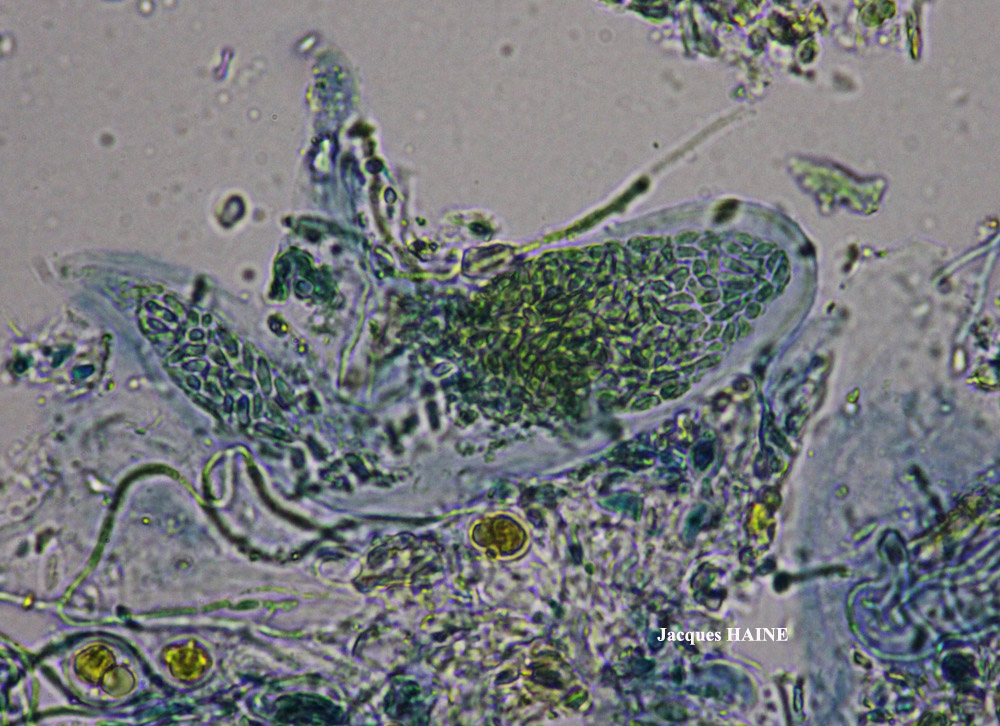 Myriospora rhagadiza forma