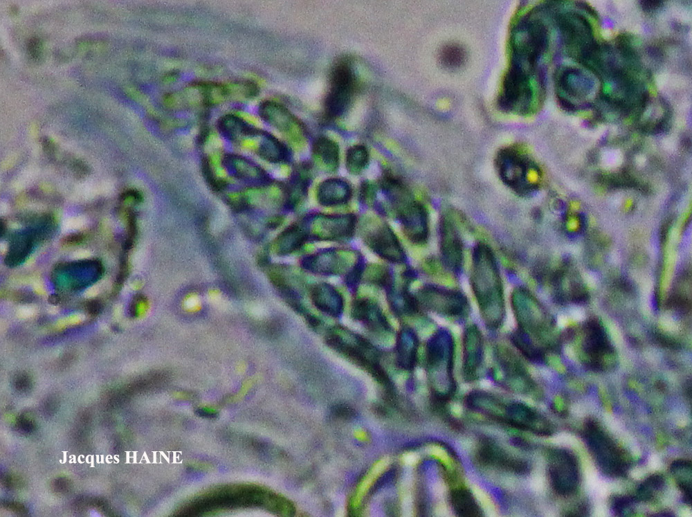 Myriospora rhagadiza forma