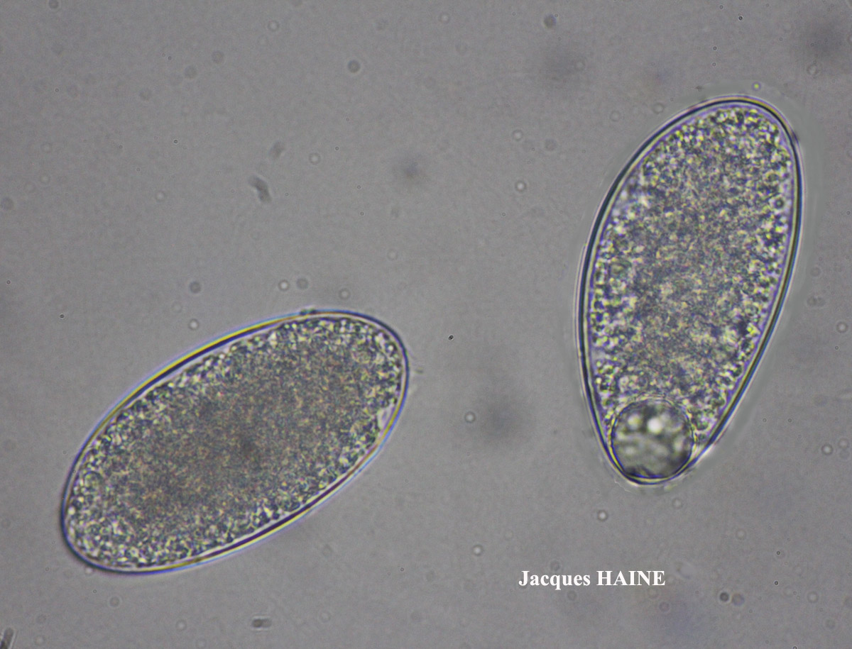Ochrolechia androgyna Taxon saxicole maritime.