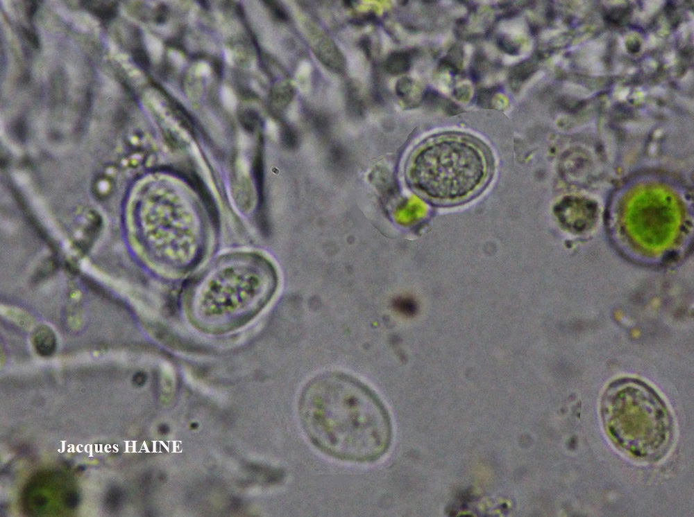 Parmelia saxatilis (L.) Ach. forme corticole