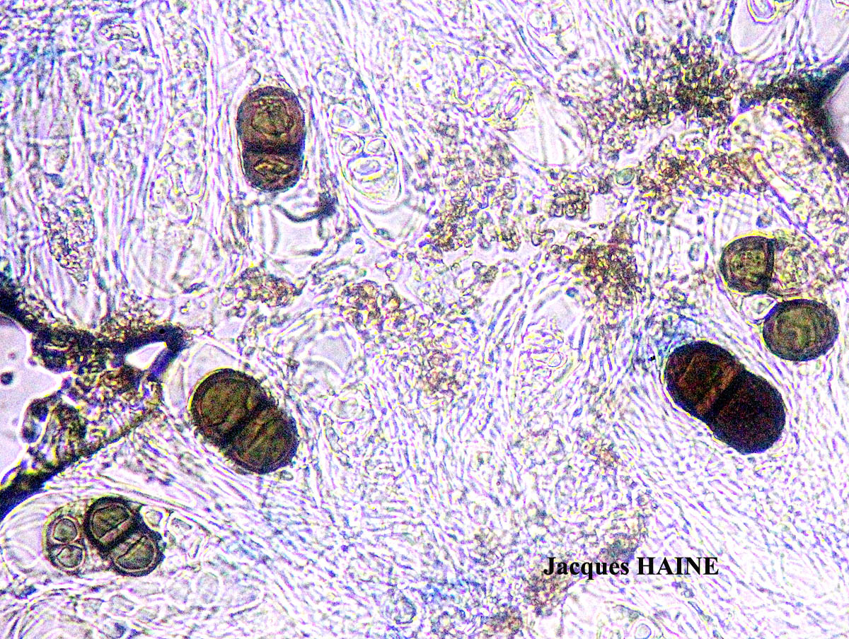 Physconia subaquila (Nyl.) Cl. Roux