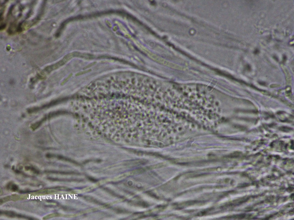Polysporina canasiacensis (Hue) Cl. Roux comb. provis. Cf.