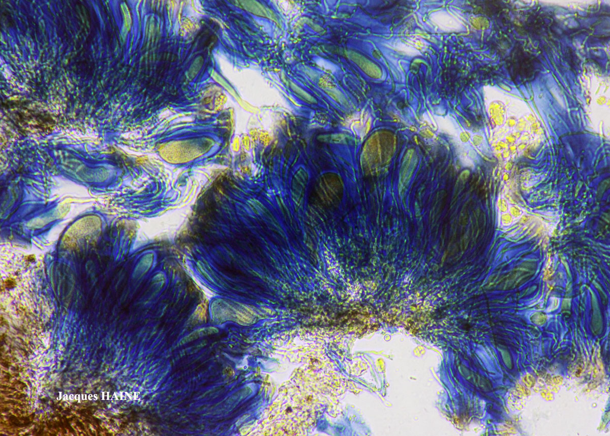 Polysporina canasiacensis (Hue) Cl. Roux comb. provis. Cf.