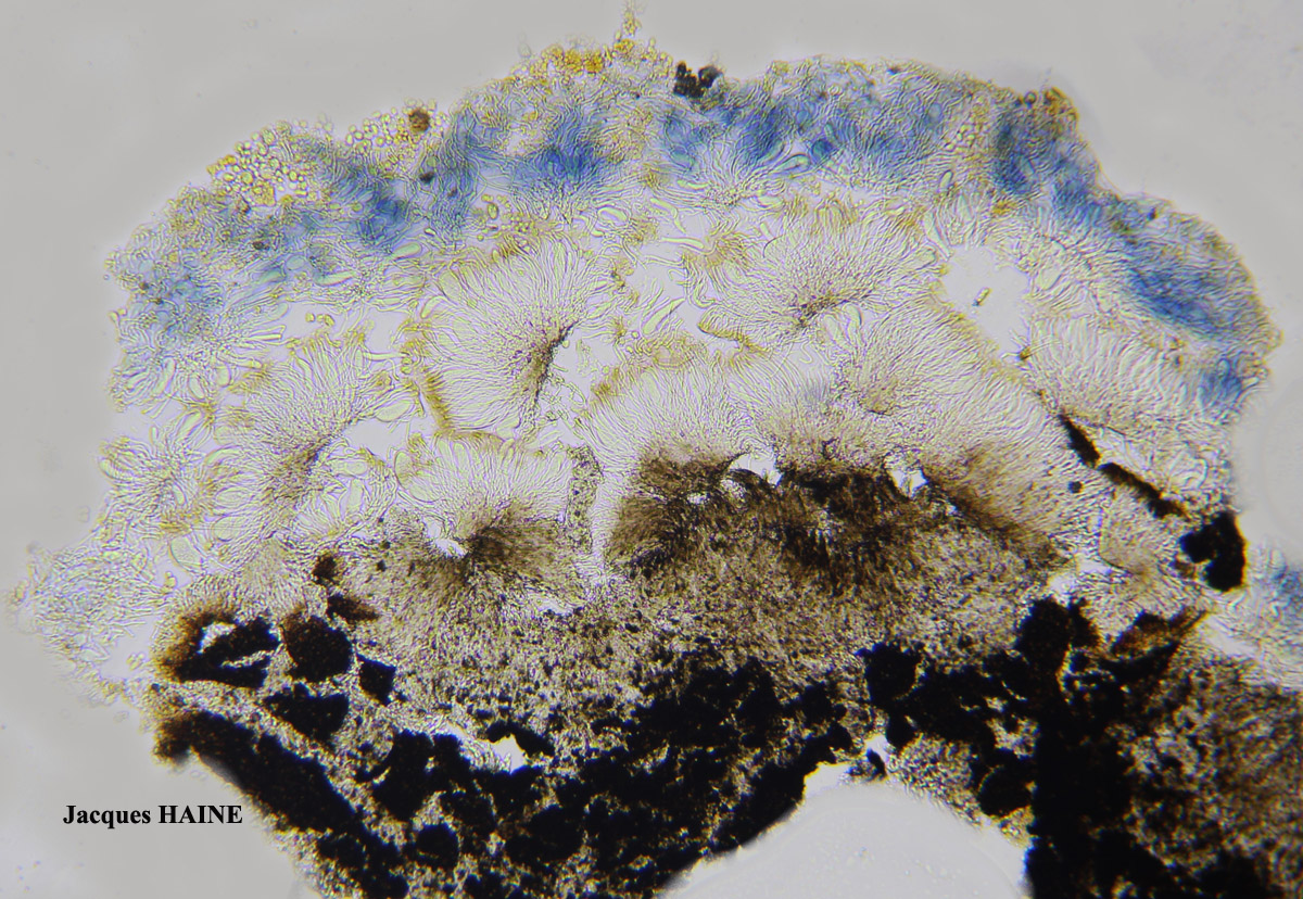 Polysporina canasiacensis (Hue) Cl. Roux comb. provis. Cf.