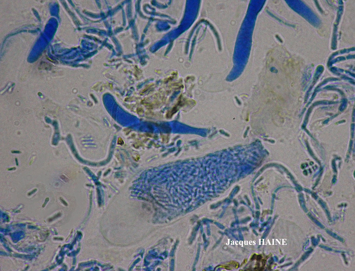 Polysporina canasiacensis (Hue) Cl. Roux comb. provis. Cf.