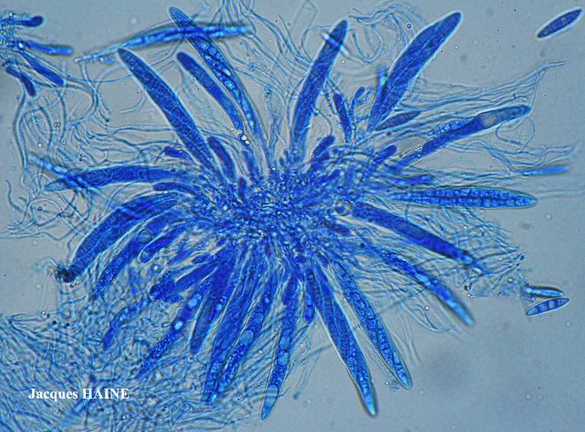 Porina linearis (Leight.) Zahlbr.