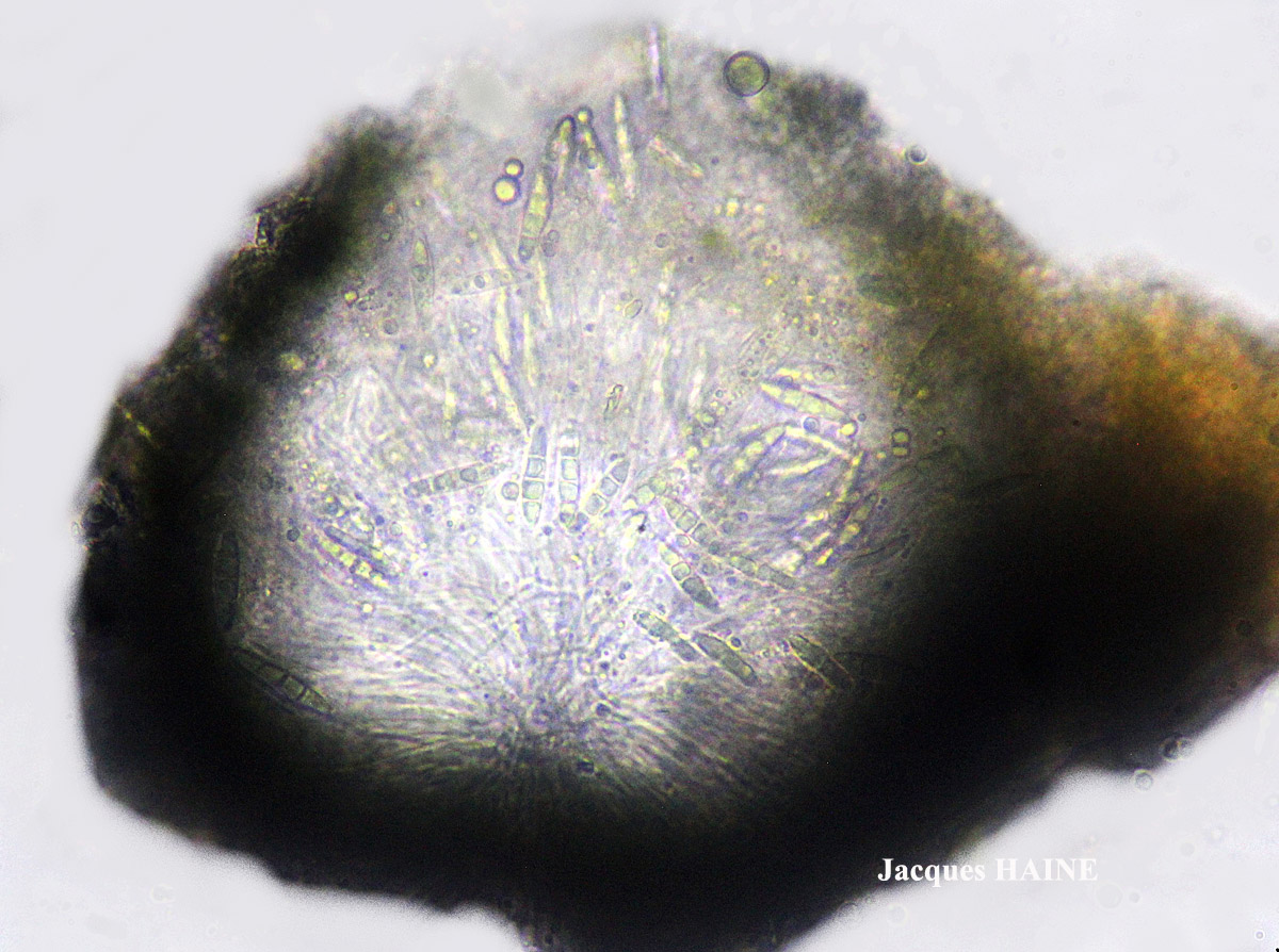 Porina linearis (Leight.) Zahlbr.