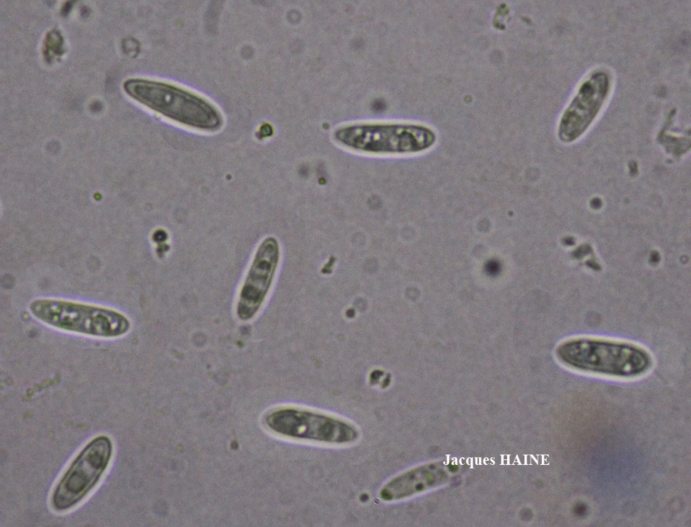Protoparmelia montagnei (Fr.) Sancho & Crespo s.l.